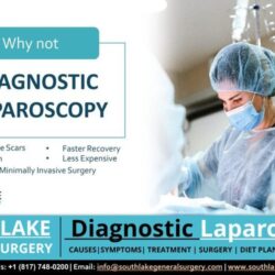 Diagnostic Laparoscopy – Purpose and Procedure