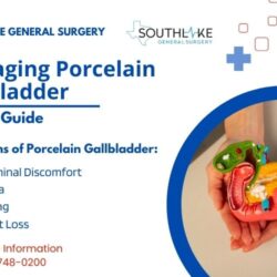 Managing Porcelain Gallbladder - Patient Guide