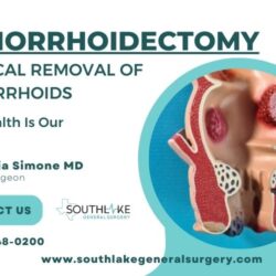 Hemorrhoidectomy Surgical Removal of Hemorrhoids