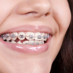 orthodontic-treatment-img1