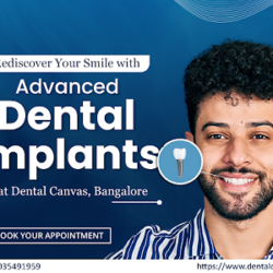 Get your dental implant treatment from dental canvas 2