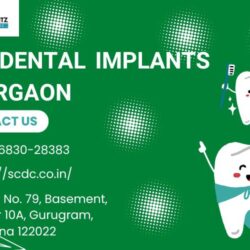 Best Dental Implants In Gurgaon311