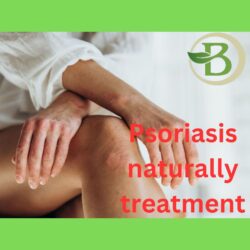 Psoriasis naturally treatment