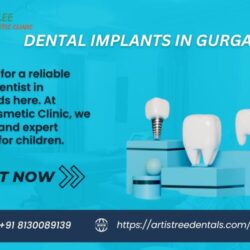 Dental Implants In Gurgaonbyshveta123124